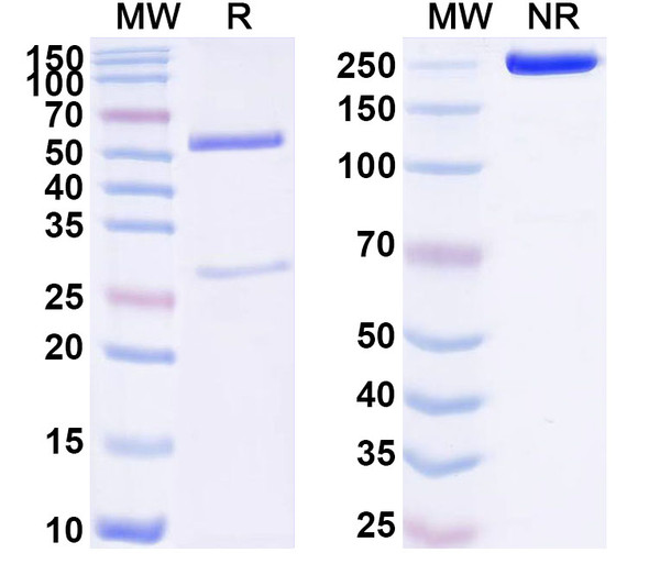 Anti-Human TRBV9 Recombinant Monoclonal Antibody (SAA1760) - SDS-PAGE