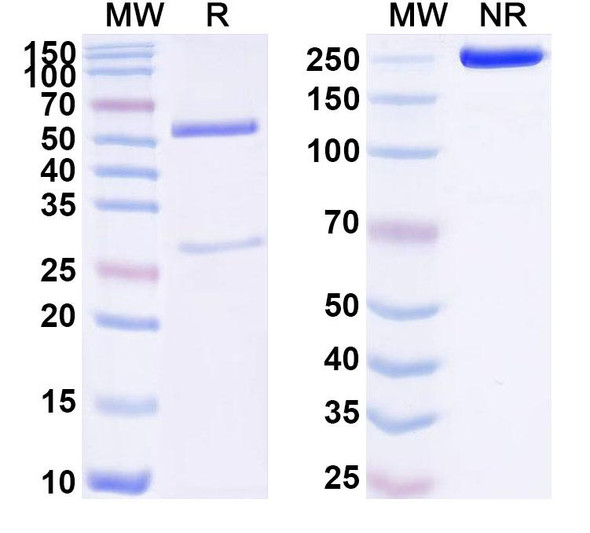 Anti-Human TRBV9 Recombinant Monoclonal Antibody (SAA1760) - SDS-PAGE