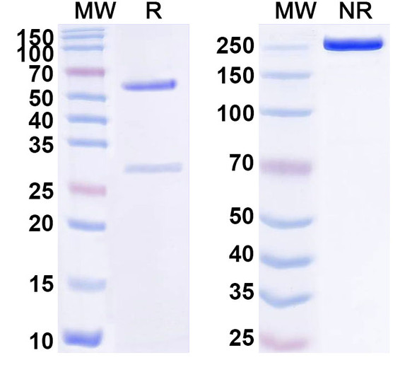Anti-Human Meflin Recombinant Monoclonal Antibody (SAA1762) - SDS-PAGE