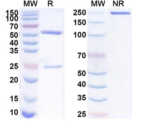 Anti-Human TRBC2 Recombinant Monoclonal Antibody (SAA1764) - SDS-PAGE