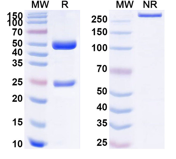 Anti-Human CETN1/Centrin-1 Recombinant Monoclonal Antibody (SAA1767) - SDS-PAGE