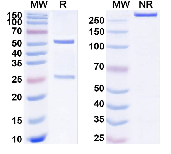 Anti-Human GAL Recombinant Monoclonal Antibody (SAA1770) - SDS-PAGE