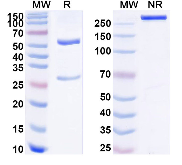 Anti-Human GMFB Recombinant Monoclonal Antibody (SAA1772) - SDS-PAGE