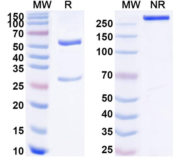 Anti-Human GMFB Recombinant Monoclonal Antibody (SAA1772) - SDS-PAGE