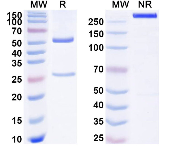 Anti-Human LEP/Leptin Recombinant Monoclonal Antibody (SAA1775) - SDS-PAGE