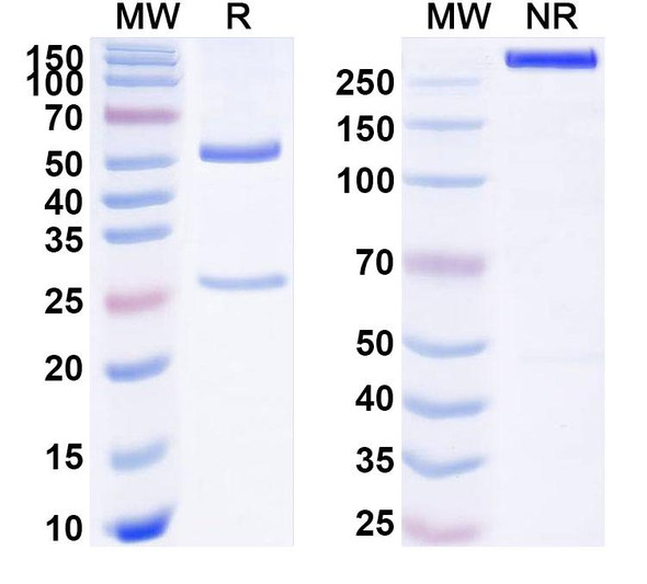 Anti-Human MDK/Midkine Recombinant Monoclonal Antibody (SAA1776) - SDS-PAGE
