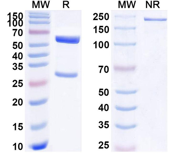 Anti-Human PSEN2/Presenilin-2 Recombinant Monoclonal Antibody (SAA1783) - SDS-PAGE