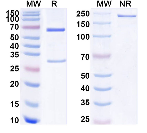 Anti-Human ALPP/PLAP Recombinant Monoclonal Antibody (SAA1786) - SDS-PAGE