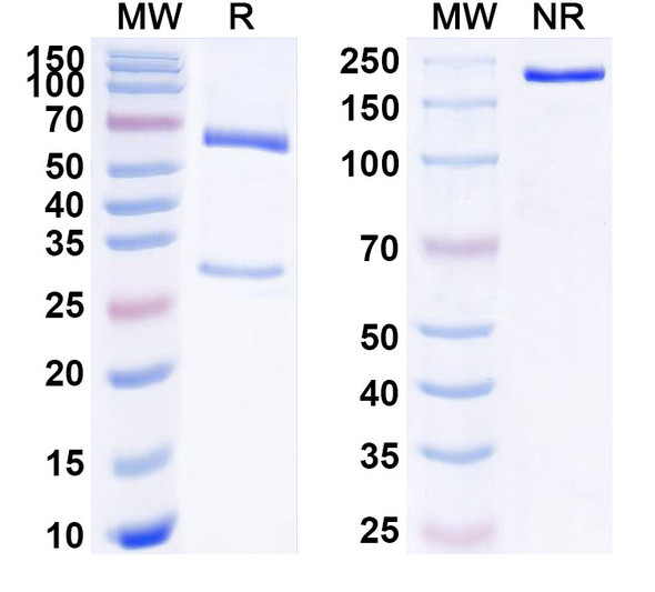 Anti-Human ADGRB1/BAI1 Recombinant Monoclonal Antibody (SAA1787) - SDS-PAGE