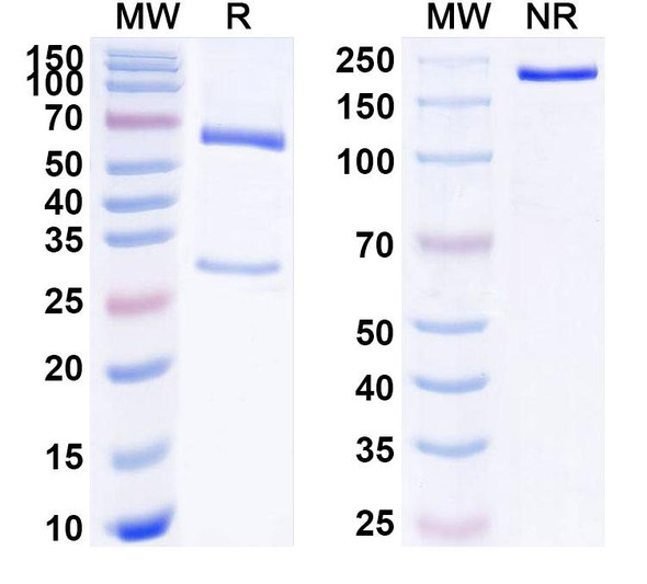 Anti-Human CAV1/Caveolin-1 Recombinant Monoclonal Antibody (SAA1788) - SDS-PAGE