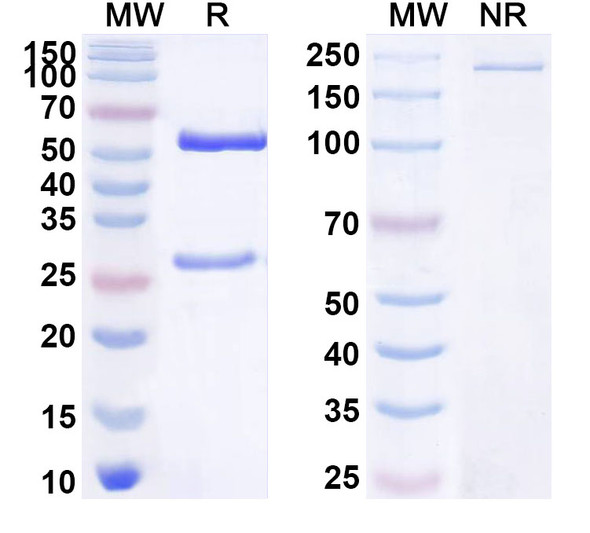 Anti-Human BMP1 Recombinant Monoclonal Antibody (SAA1793) - SDS-PAGE