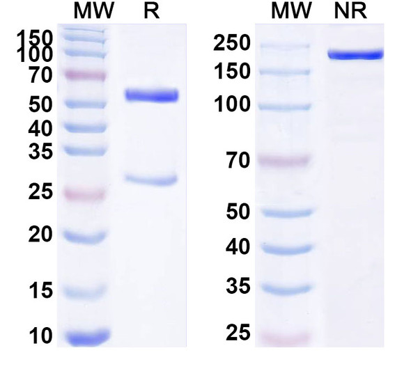 Anti-Human F10/Factor X Recombinant Monoclonal Antibody (SAA1800) - SDS-PAGE