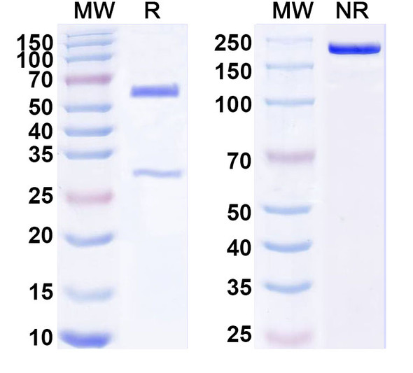 Anti-Human TGFBR2/TGFR-2 Recombinant Monoclonal Antibody (SAA1803) - SDS-PAGE