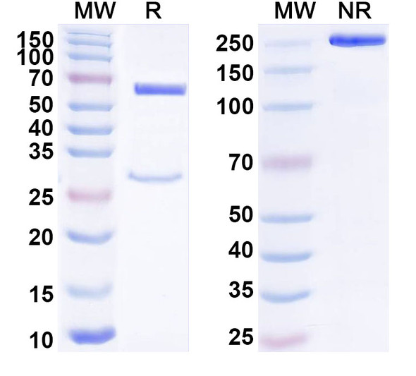 Anti-Human CD201/PROCR/EPCR Recombinant Monoclonal Antibody (SAA1813) - SDS-PAGE