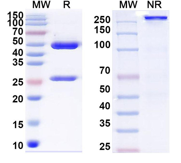 Anti-Human NPR1/NPR-A Recombinant Monoclonal Antibody (SAA1818) - SDS-PAGE