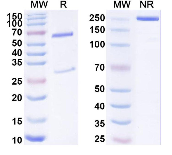 Anti-Human MIG7 Recombinant Monoclonal Antibody (SAA1822) - SDS-PAGE