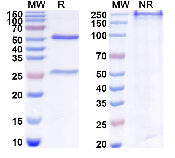 Anti-Human TNFSF12/APO3L/TWEAK Recombinant Monoclonal Antibody (SAA1825) - SDS-PAGE