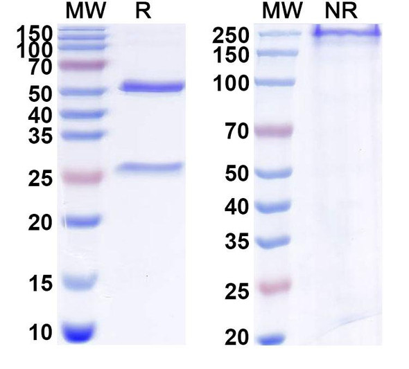 Anti-Human TNFSF12/APO3L/TWEAK Recombinant Monoclonal Antibody (SAA1825) - SDS-PAGE
