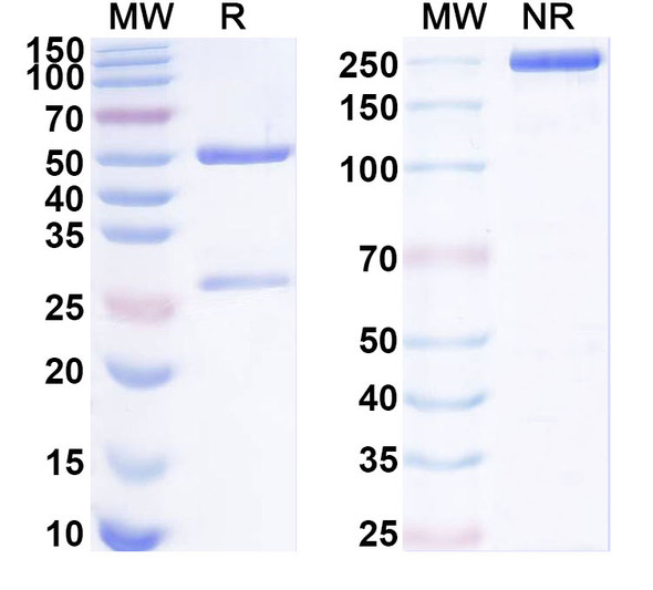 Anti-Human SLPI Recombinant Monoclonal Antibody (SAA1833) - SDS-PAGE