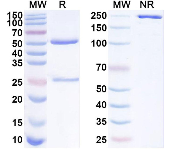 Anti-Human GJB2 Recombinant Monoclonal Antibody (SAA1838) - SDS-PAGE