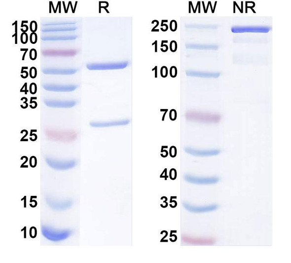 Anti-Human CCSAP Recombinant Monoclonal Antibody (SAA1842) - SDS-PAGE