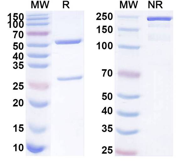 Anti-Human PTCRA Recombinant Monoclonal Antibody (SAA1843) - SDS-PAGE