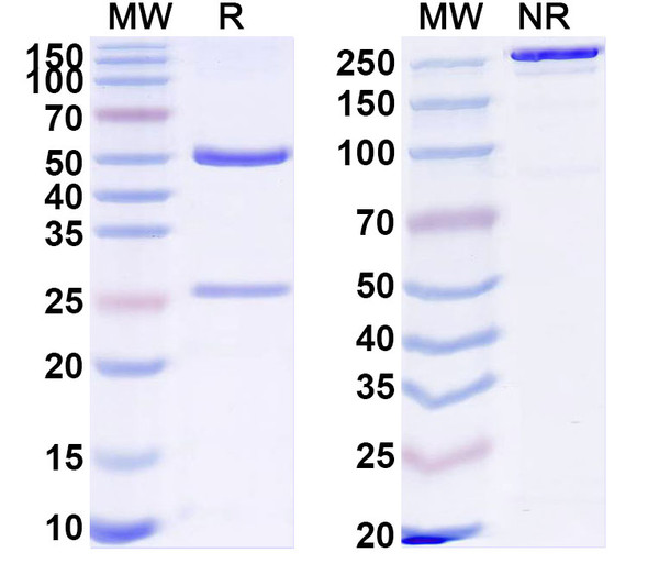 Anti-Human SPNS2 Recombinant Monoclonal Antibody (SAA1862) - SDS-PAGE