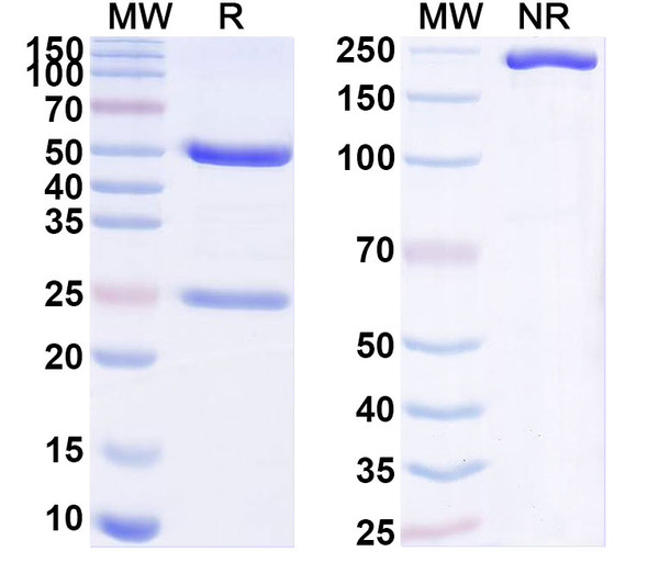 Anti-Human DENND1A Recombinant Monoclonal Antibody (SAA1871) - SDS-PAGE