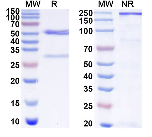 Anti-Human NGLY1 Recombinant Monoclonal Antibody (SAA1882) - SDS-PAGE