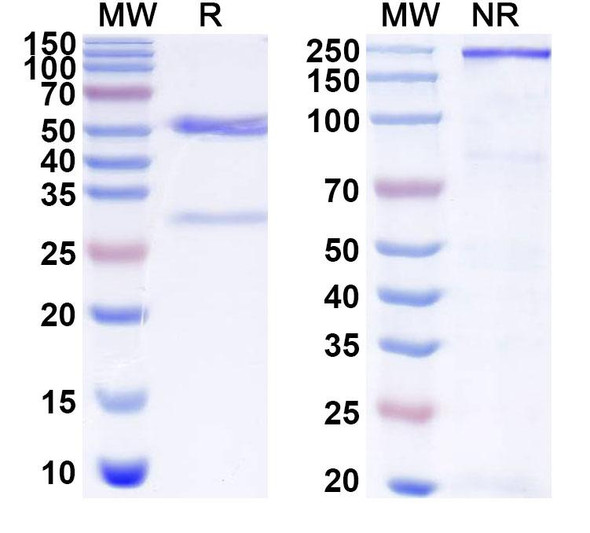 Anti-Human MAP6 Recombinant Monoclonal Antibody (SAA1883) - SDS-PAGE