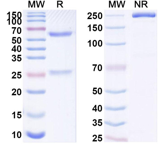 Anti-Human C9orf72 Recombinant Monoclonal Antibody (SAA1886) - SDS-PAGE