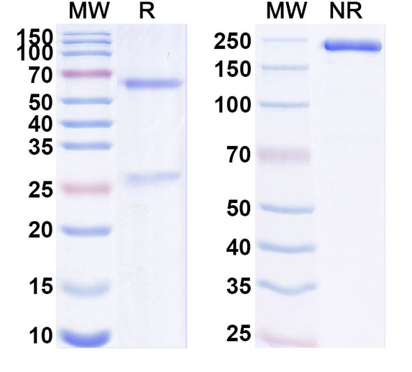 Anti-Human PRAP1/uPA Recombinant Monoclonal Antibody (SAA1888) - SDS-PAGE