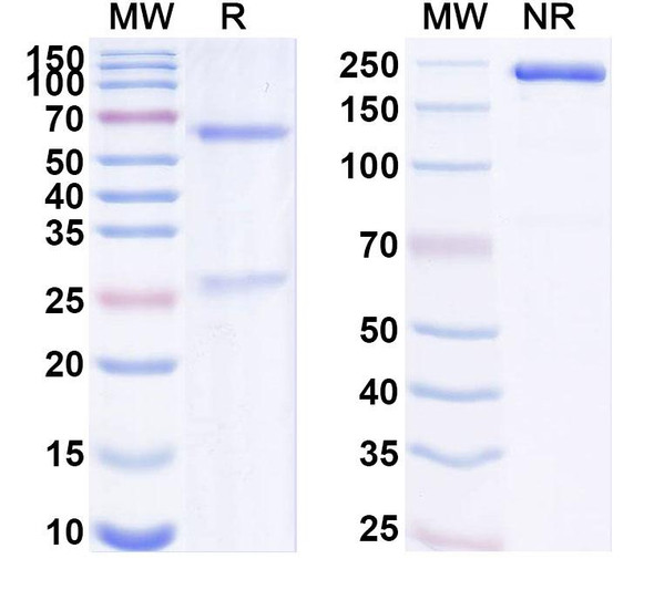 Anti-Human DCBLD2/CLCP1 Recombinant Monoclonal Antibody (SAA1889) - SDS-PAGE