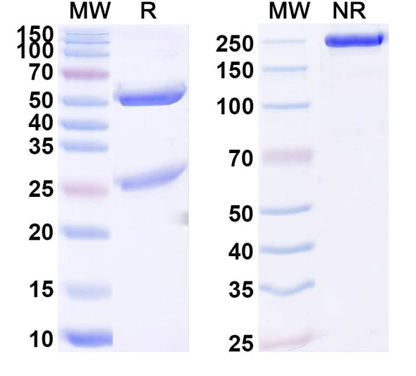 Anti-Human SLC29A1/hENT1 Recombinant Monoclonal Antibody (SAA1893) - SDS-PAGE