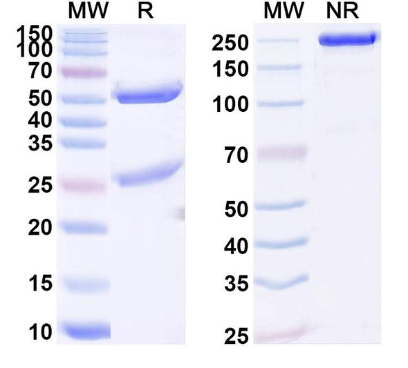 Anti-Human SFXN3 Recombinant Monoclonal Antibody (SAA1894) - SDS-PAGE