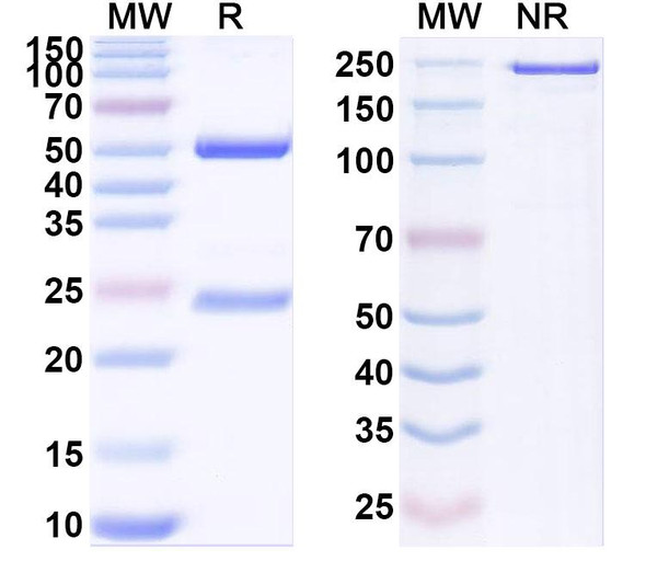Anti-Human FUT8 Recombinant Monoclonal Antibody (SAA1898) - SDS-PAGE