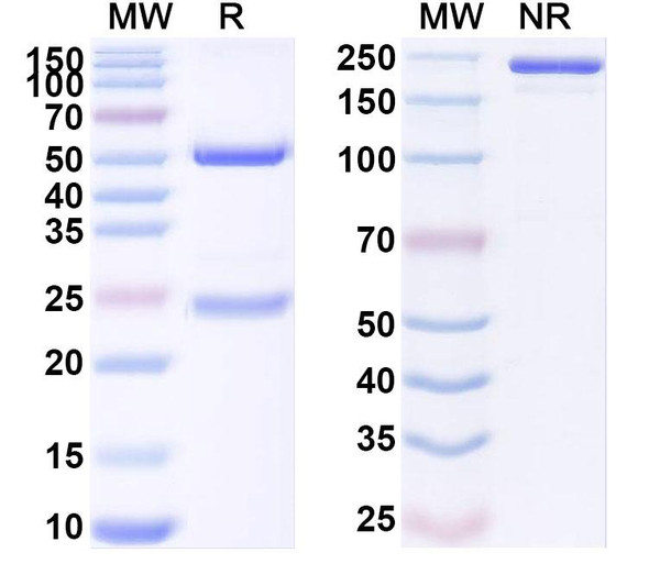 Anti-Human GFRA4 Recombinant Monoclonal Antibody (SAA1900) - SDS-PAGE