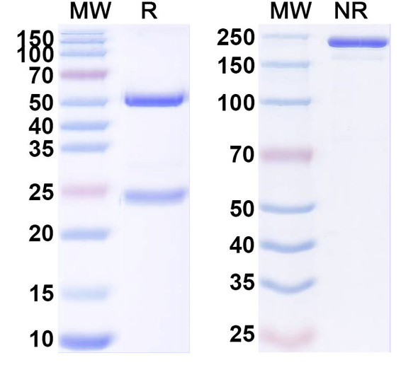 Anti-Human DCSTAMP Recombinant Monoclonal Antibody (SAA1901) - SDS-PAGE