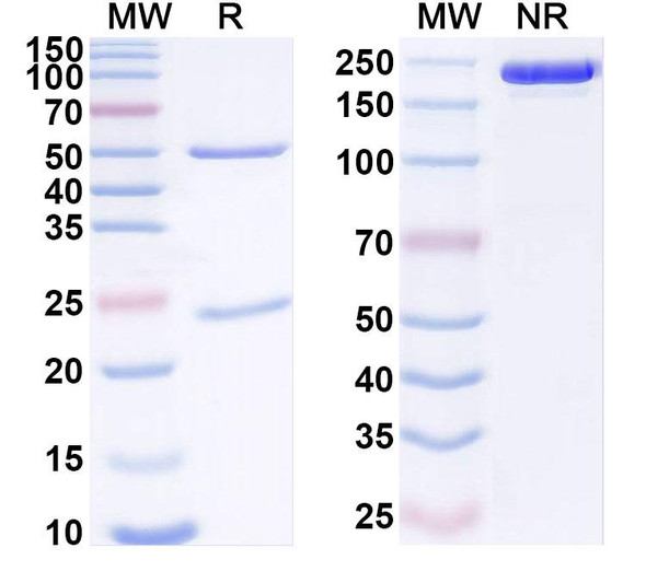 Anti-Human PLAC1 Recombinant Monoclonal Antibody (SAA1906) - SDS-PAGE