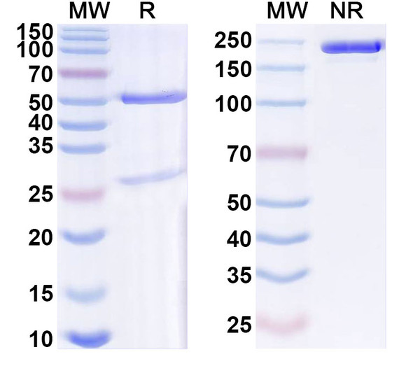 Anti-Human ROBO2 Recombinant Monoclonal Antibody (SAA1908) - SDS-PAGE