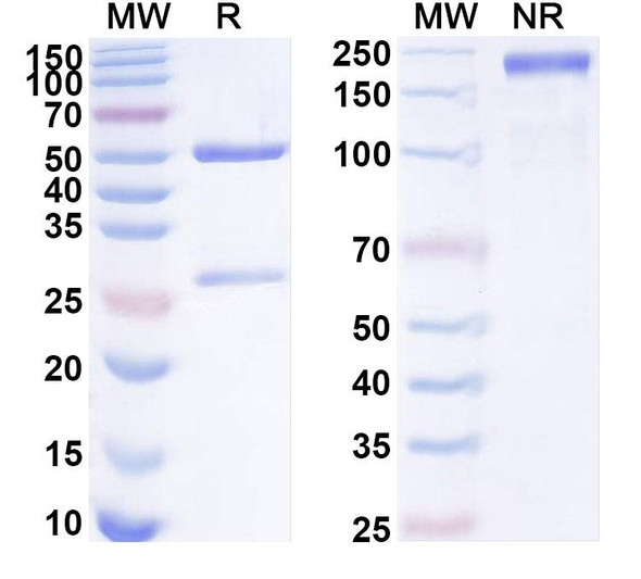 Anti-Human TMEM106B Recombinant Monoclonal Antibody (SAA1912) - SDS-PAGE