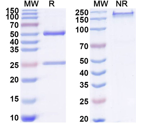 Anti-Human SERPINB13 Recombinant Monoclonal Antibody (SAA1915) - SDS-PAGE