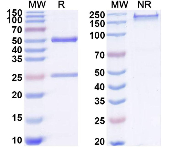 Anti-Human SERPINB13 Recombinant Monoclonal Antibody (SAA1915) - SDS-PAGE