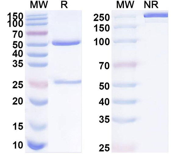 Anti-Human EMCN Recombinant Monoclonal Antibody (SAA1917) - SDS-PAGE