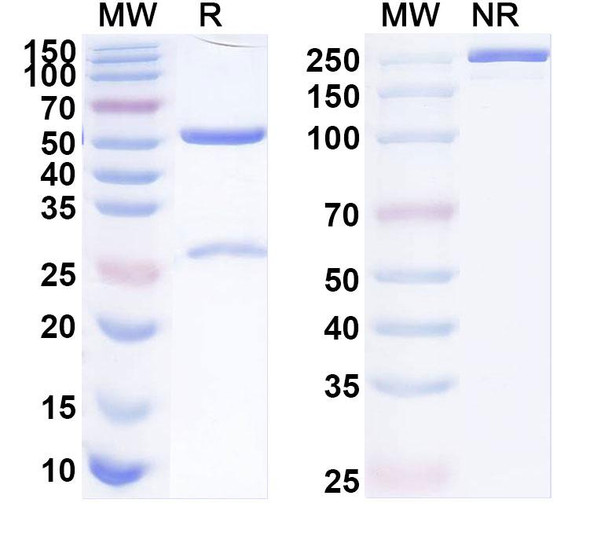 Anti-Human PLAGL1 Recombinant Monoclonal Antibody (SAA1920) - SDS-PAGE