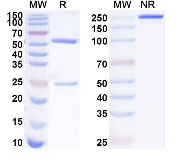 Anti-Human NME7 Recombinant Monoclonal Antibody (SAA1925) - SDS-PAGE