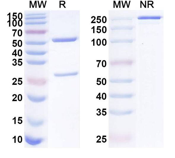 Anti-Human PRSS21 Recombinant Monoclonal Antibody (SAA1927) - SDS-PAGE