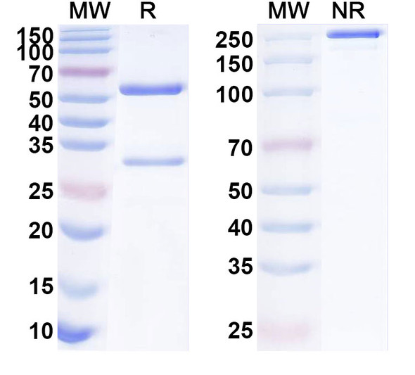 Anti-Human TLL2 Recombinant Monoclonal Antibody (SAA1930) - SDS-PAGE