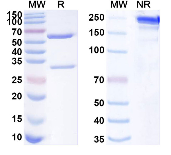 Anti-Human GNLY/Granulysin Recombinant Monoclonal Antibody (SAA1936) - SDS-PAGE