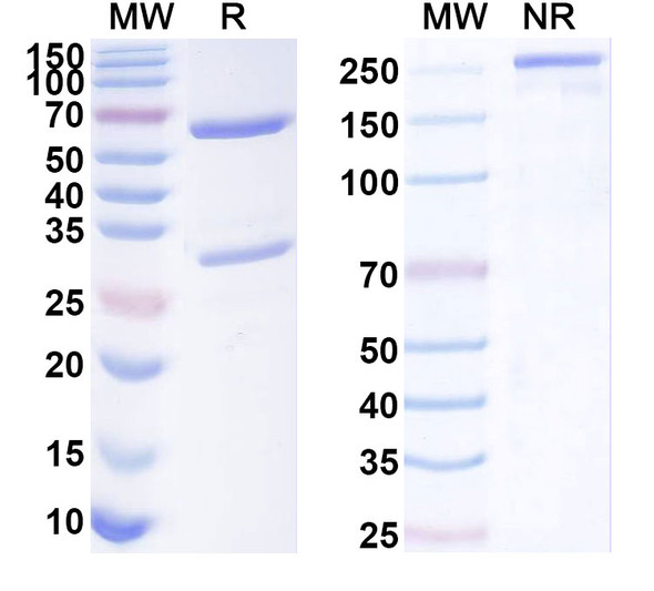 Anti-Human CD121b/IL1R2/IL-2R beta Recombinant Monoclonal Antibody (SAA1939) - SDS-PAGE